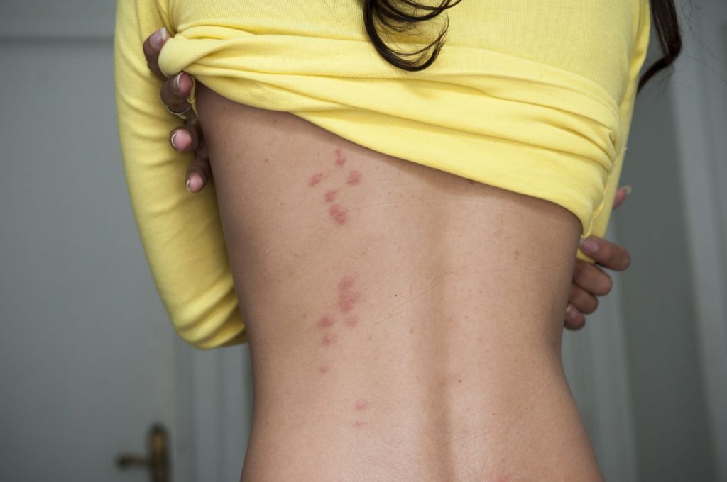 Bed Bug Removal Heat Treatment